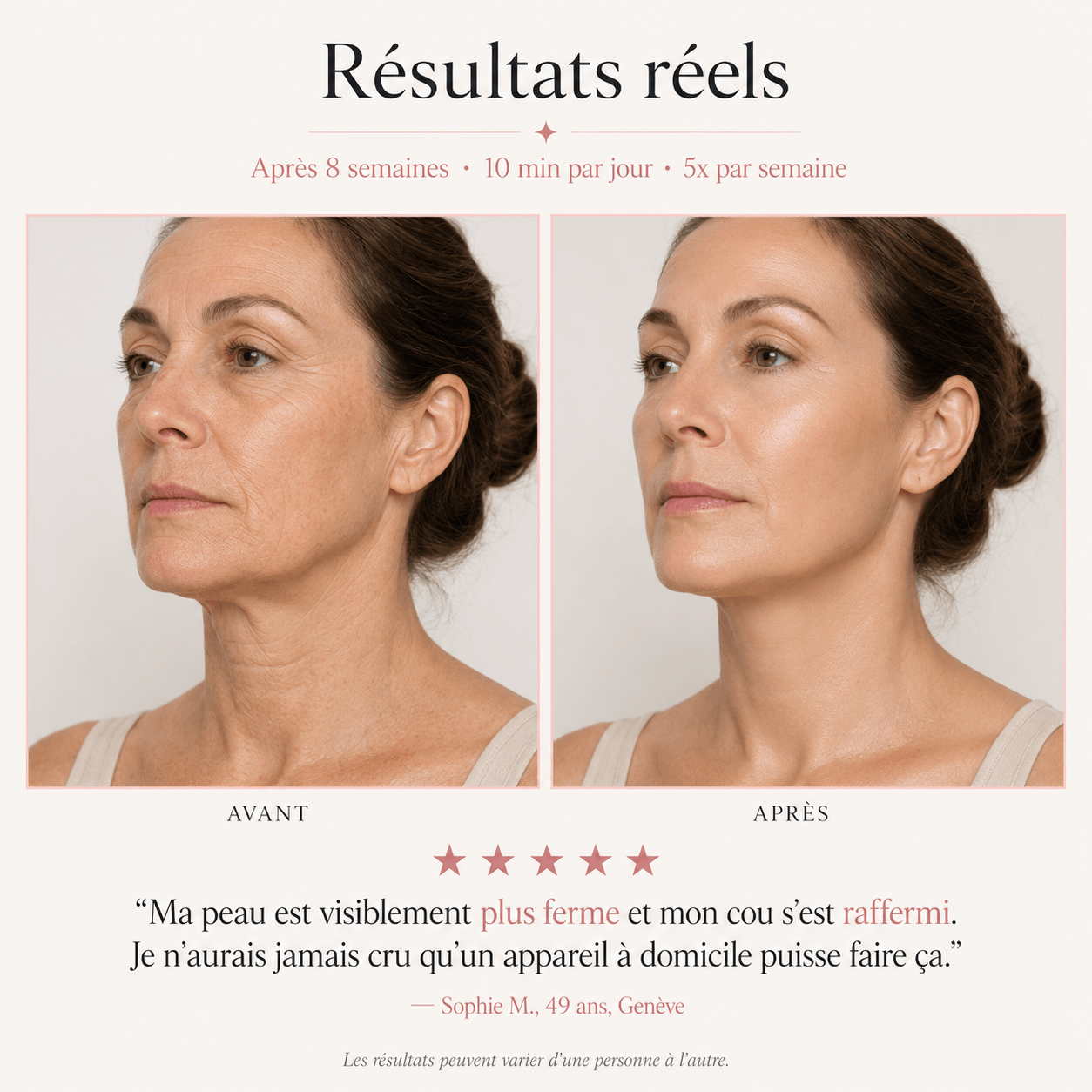 Résultats réel masque luxexia