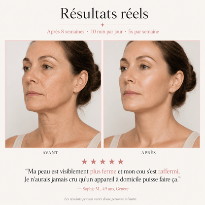 Résultats réel masque luxexia